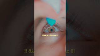 تجربتي مع الليزك بعد سنة !!👁️😕