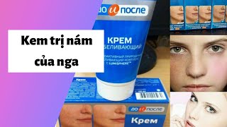 Review 5 kem trị nám của nga Tốt, Hiệu quả, An toàn nhất hiện nay.