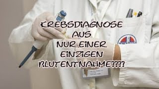 Krebsdiagnose mit nur einem Bluttest?