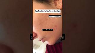 من به فکر پوست شما خوشکلام منو دنبال کنید هروز براتون پستای اموزشی میذارم #bts #방탄소년단 #پوست_زیبا #