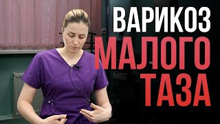 Варикоз малого таза у женщин. Как лечится?