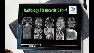 Radiology Flash Cards Set 1   #Sravan Krishna Reddy