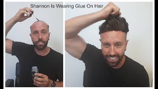 Shannon Buys & Bonds An Online Men's Hair Piece