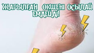 ӨКШЕ ЖАРЫЛҒАНДА ҚАЛАЙ ЕМДЕЙДІ, ӘЙЕЛДЕРДІҢ ӘЛСІЗ ТҰСЫ ОСЫ, Өкше,  Керек