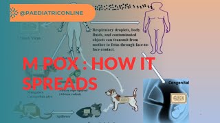 M Pox: How it spreads| Who are at risk by Dr Meena Choudhary #health #mpox #awareness #outbreak