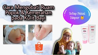 Cara Mengobati Ruam Popok & Kemerahan pada Kulit Bayi | Kasian ruam sampai rewel 😩