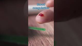 Blood coagulation │ Selected medical terminology │ #medicalterminology #short