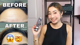 CURRENTBODY SKIN RF DEVICE | Radio Frequency Skin Tightening At HOME! With BEFORE & AFTER RESULTS!!!