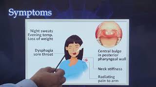 Chronic Retropharyngeal Abscess / English  / Patient teaching programme