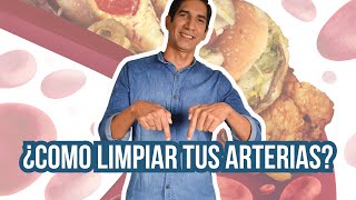 Limpieza arterial 😮: Descubre las mejores estrategias para mantener tus arterias saludables.