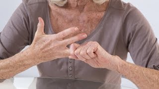 Arthritis is on the rise