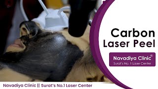 Hollywood facial laser peel treatment - Dr. Sandip Navadiya