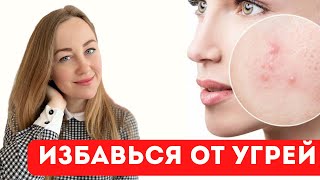 Питайся так и ты избавишься от акне без усилий! Угревая сыпь и диета