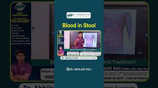 Blood in Stool || Causes and Treatment of Rectal Bleeding in Hindi || Dr Abhilash Nali || #shorts