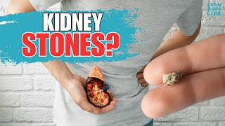 Warning Signs and Symptoms of Kidney Stone Passing