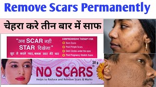 No Scars Cream | Benefits of No Scars Cream