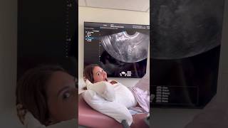 Francesca Farago & Jesse Sullivan Share Pregnancy Journey and Baby Name Tease #shorts #shortvideo