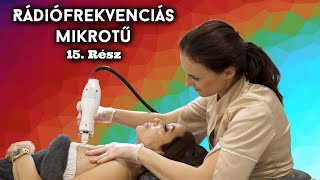 EverDerm Reality 2. évad - RF Mikrotűs kezelés - 15. rész