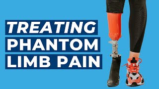 What is Targeted Muscle Reinnervation? | Treating Phantom Limb Pain