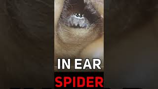 SHE WAS SLEEPING WHEN THIS SPIDER CRAWLED INTO HER EAR...