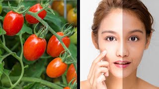 5 Surprising Home Remedies By Using Tomato | Health Tips