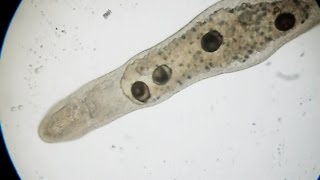 Stenostomum leucops