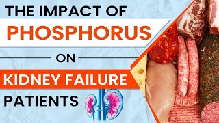 The Impact Of Phosphorus On Kidney Failure Patients.