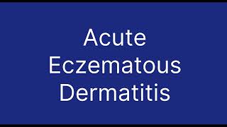 Acute Eczematous Dermatitis