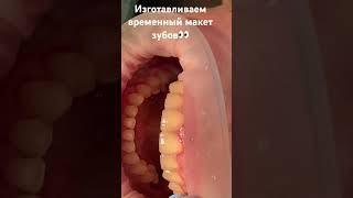 Изготавливаем временные коронки,перед тем как приступить к постоянным)#teeth#good#smile