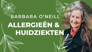 4. Allergieën en Huidziekten | Barbara O'Neill