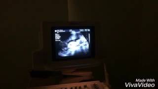 Sonogram