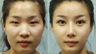 South Korea Craze with Plastic Surgery.