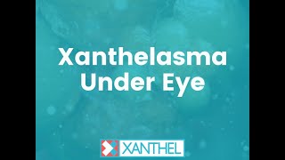 Xanthelasma Under Eye - Find Out More About Xanthelasma Under Eye - By XANTHEL ®