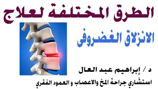 الطرق المختلفه لعلاج الانزلاق الغضروف مع الدكتور ابراهيم عبد العال استشارى جراحة المخ والاعصاب.