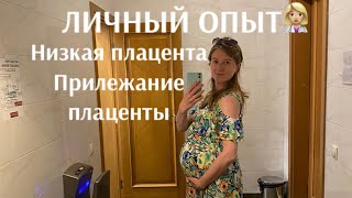 Прилежание плаценты, низкое расположение плаценты, личный опыт, роды с низкой плацентой