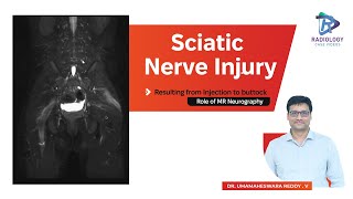 Sciatic Nerve Injury Resulting from Injection to buttock: Role of MR Neurography #Damayanthi