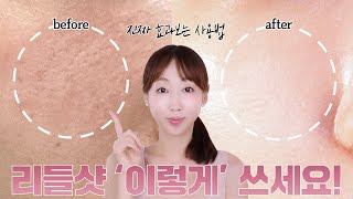 리들샷은 ‘이렇게’ 써야 됩니다🙋🏻‍♀️❗브랜드가 알려주지 않은 찐으로 효과 보는 리들샷 활용법 3가지💸