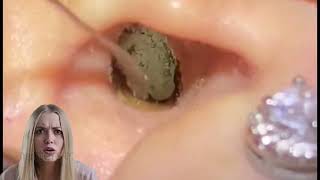 Dr.Natacha, earwax removal satisfying relaxing asmr video.