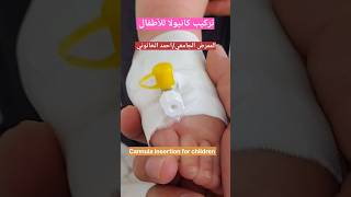 تركيب كانيولا للأطفال Cannula insertion for children