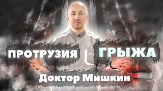 ГРЫЖА. Способы лечения | Может ли ГРЫЖА исчезнуть без операции | Доктор Мишкин