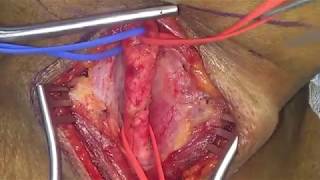 Carotid sheath and it's contents | Anatomy |