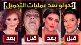 فنانين تحول شكلهم ١٨٠ درجة بعد عمليات التجميل !!