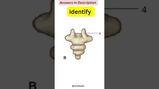 identify the parts of vertebrae Quiz || vertebral column anatomy quiz