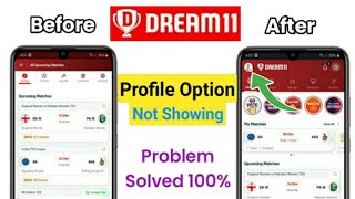 dream 11 me profile ka option nahi aa raha hai | dream11 profile not showing 2024