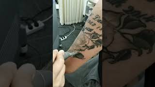 Pico laser machine do tattoo removal treatment