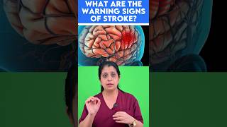 ⚠️Warning signs of stroke🧠