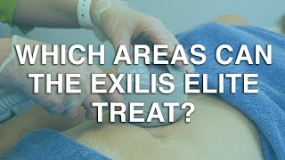 Which areas can the Exilis Elite Treat? | The Body Clinic | Exilis Elite Fat Reduction FAQ 🎯