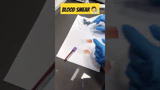 How to prepare blood Smear 🩸#medical #viralvideo #youtubeshorts #youtube #shorts #medicallabtech#lab