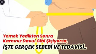 Yemek Yedikten Sonra Karnınız Davul Gibi Şişiyorsa, İŞTE GERÇEK SEBEBİ VE TEDAVİSİ..