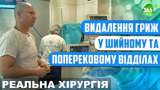 Поперековий Остеохондроз і Ускладнення Грижою. Видалення Гриж в Шийному Відділі.